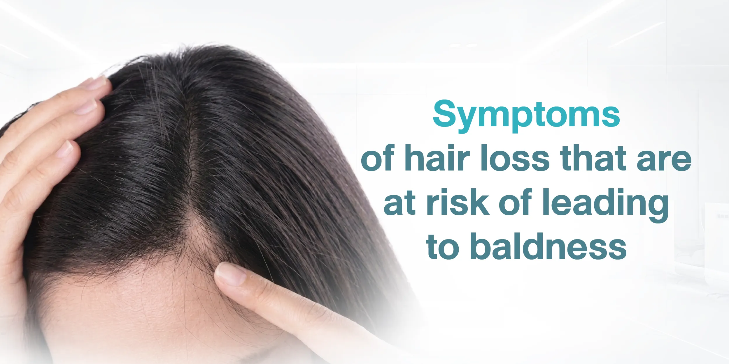 Symptoms of hair loss that are at risk of leading to baldness