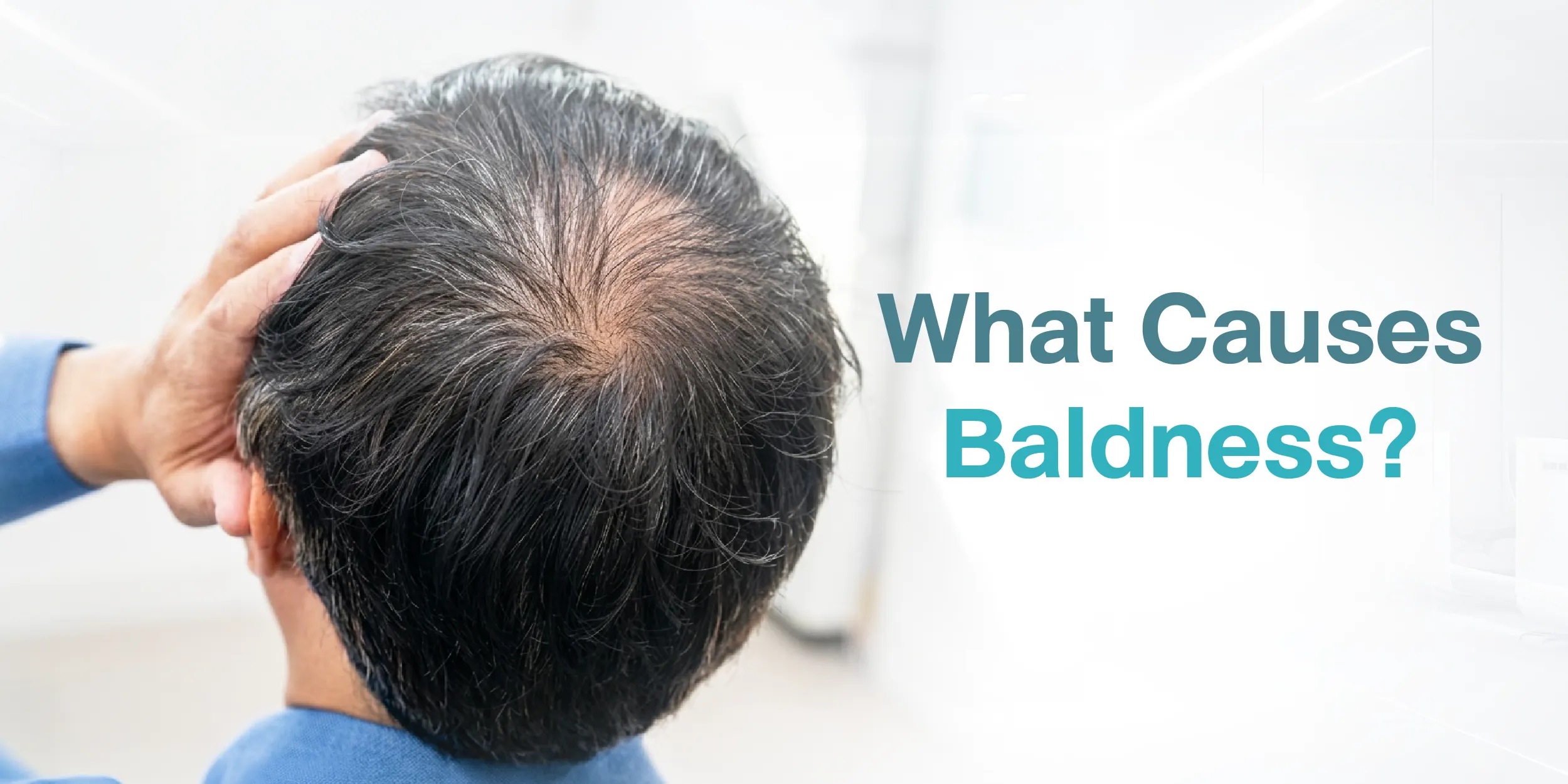What Causes Baldness