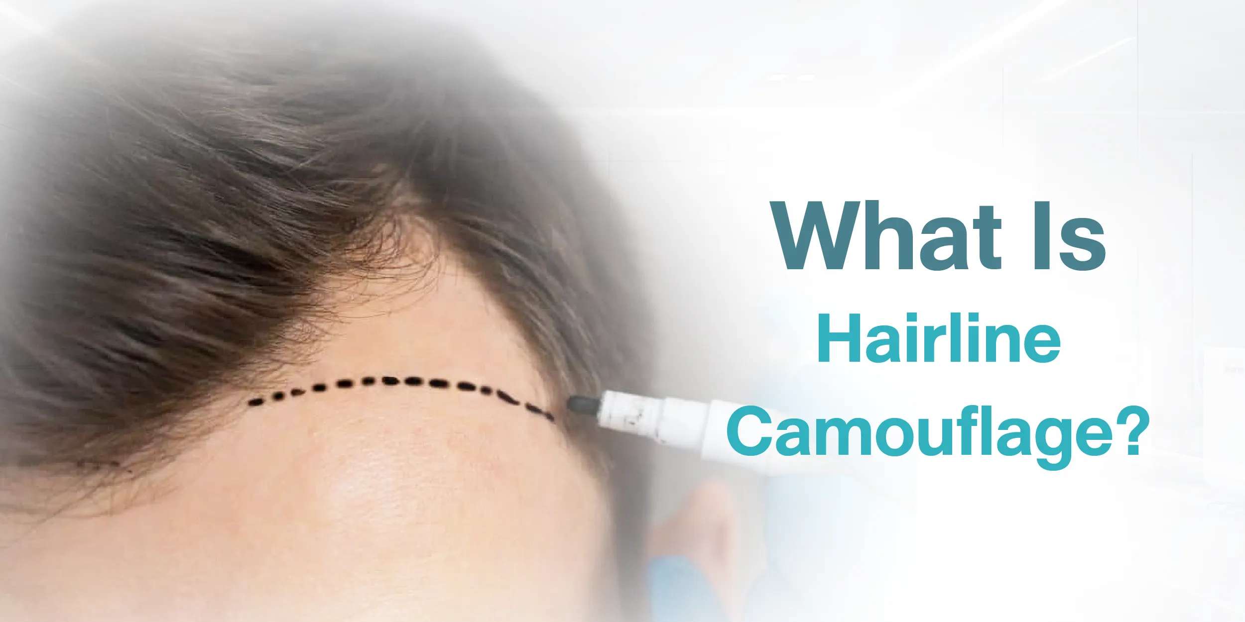 What Is Hairline Camouflage