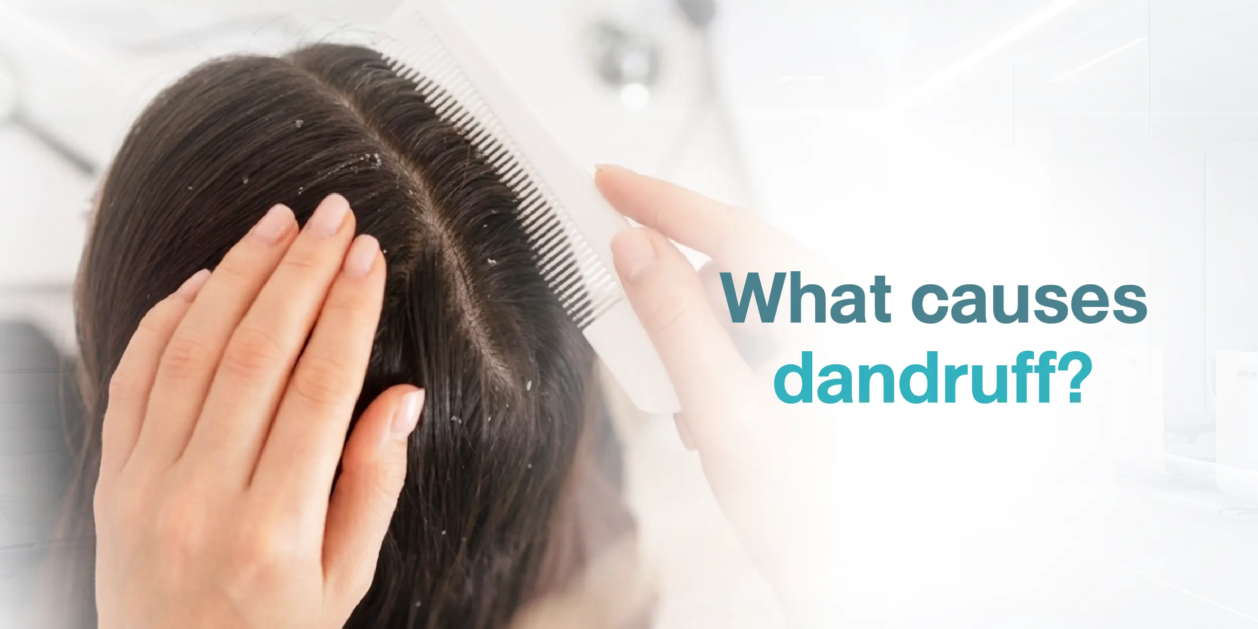 What causes dandruff