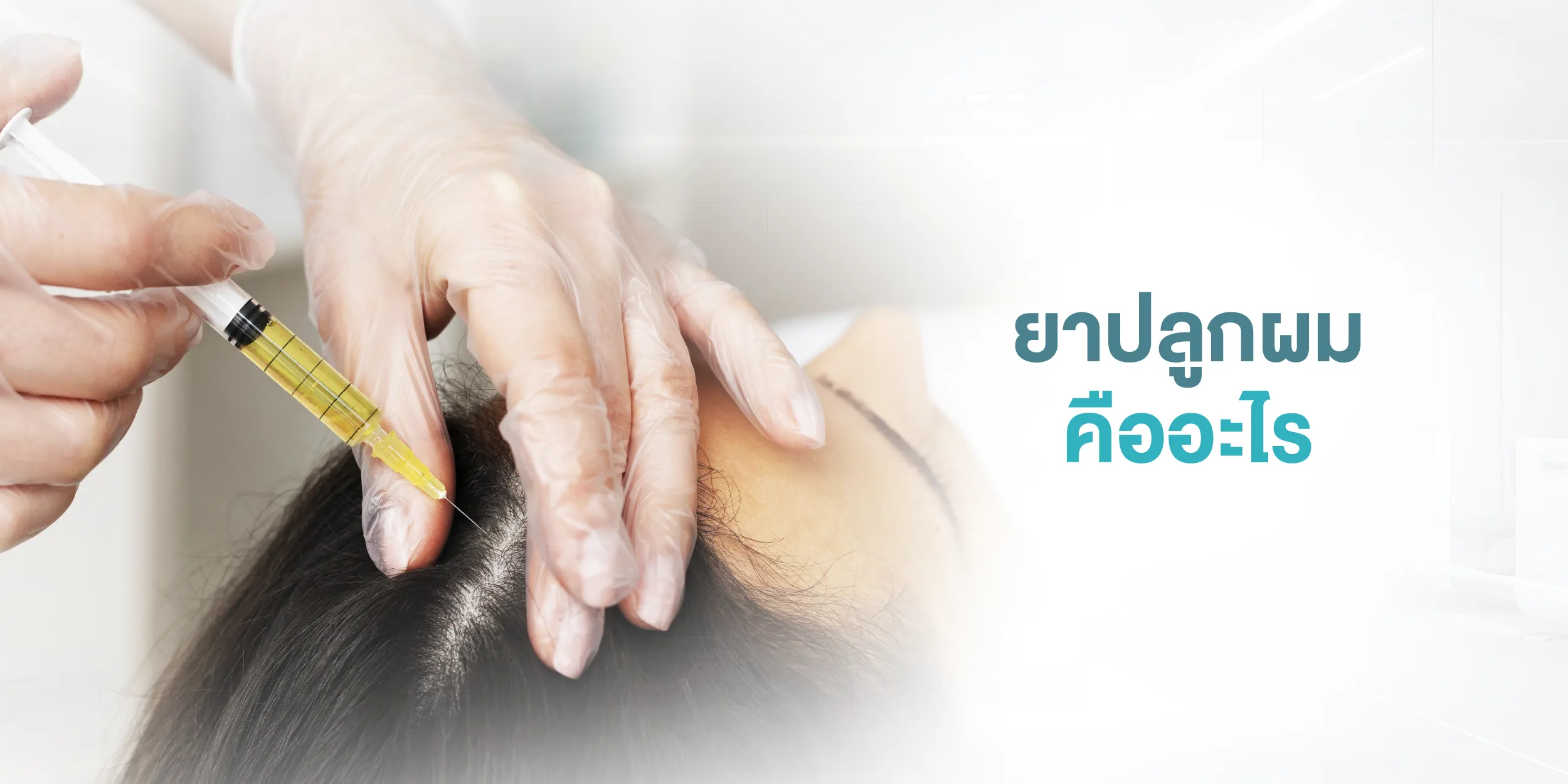 ยาปลูกผม คืออะไร