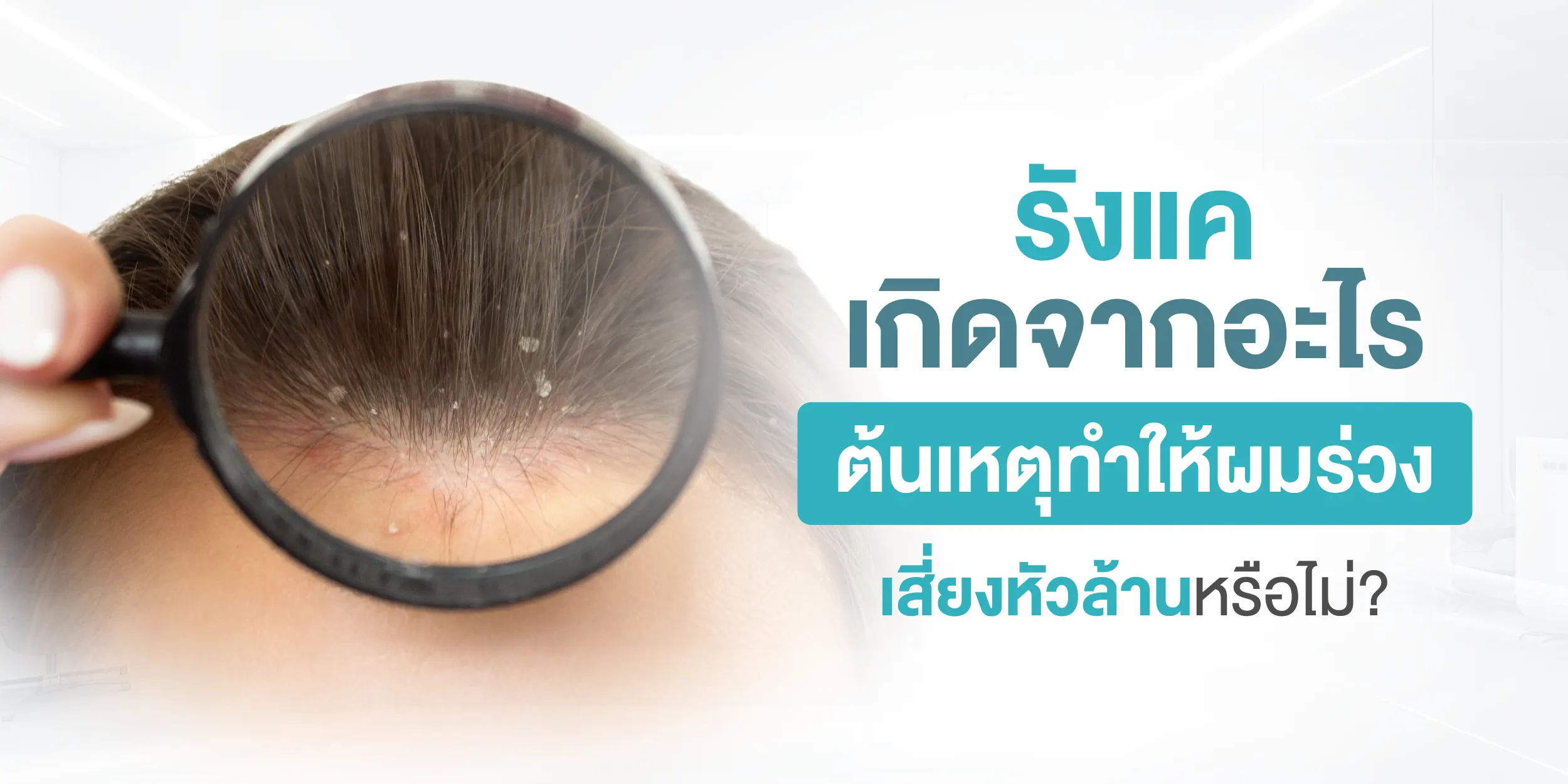 รังแค เกิดจากอะไร ต้นเหตุทำให้ผมร่วง เสี่ยงหัวล้านหรือไม่
