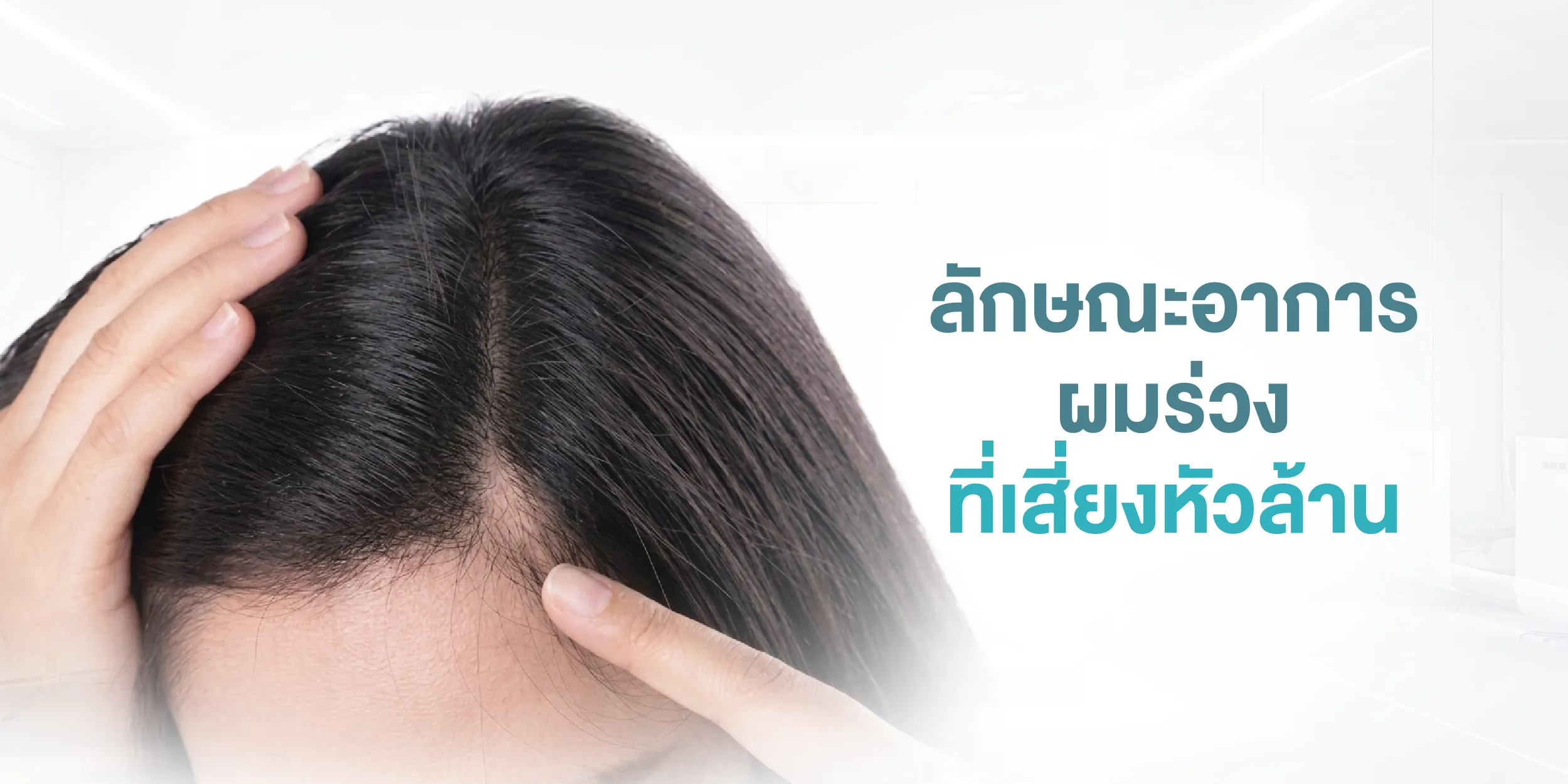 ลักษณะอาการผมร่วงที่เสี่ยงหัวล้าน