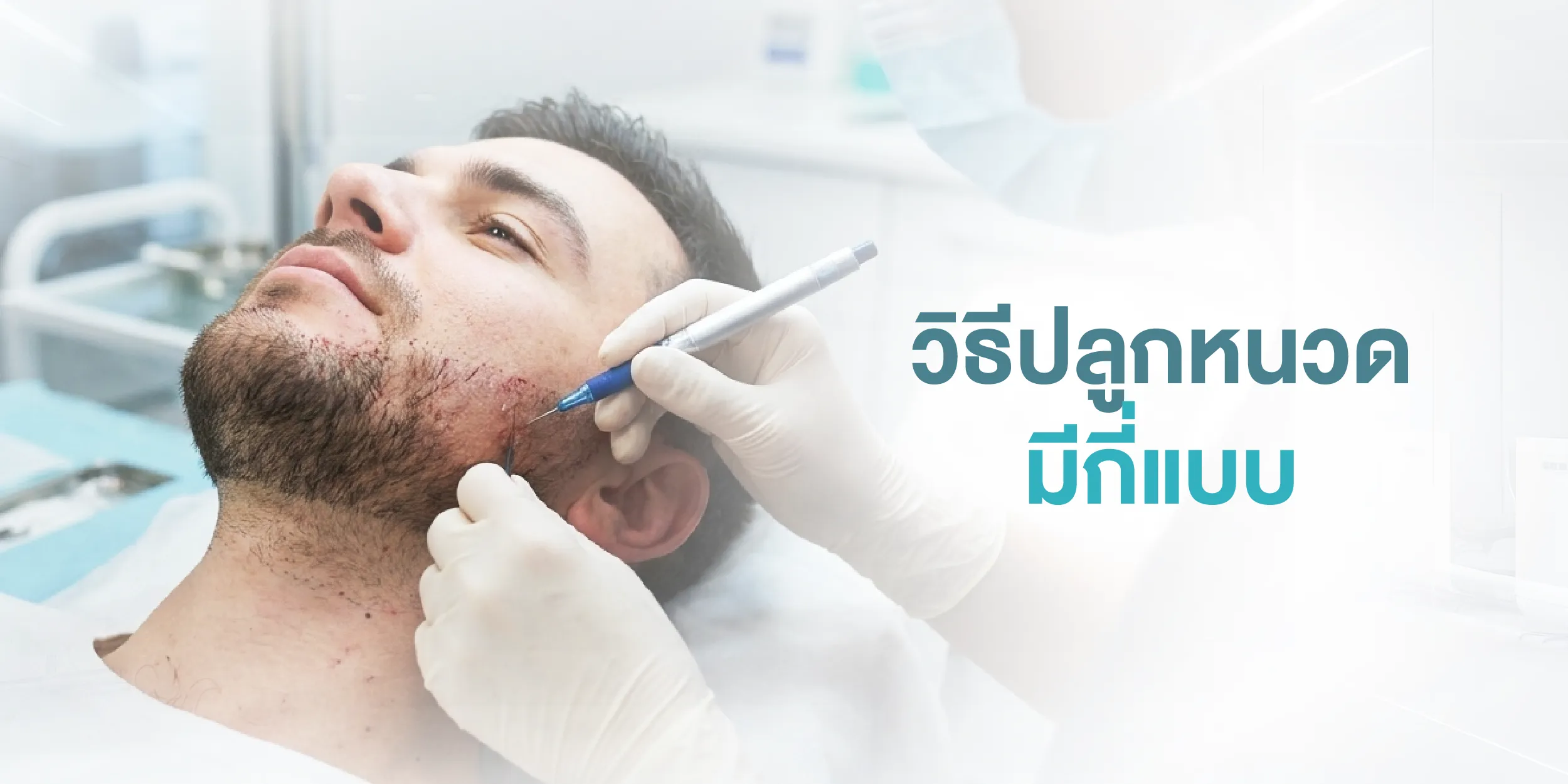 วิธีปลูกหนวดมีกี่แบบ
