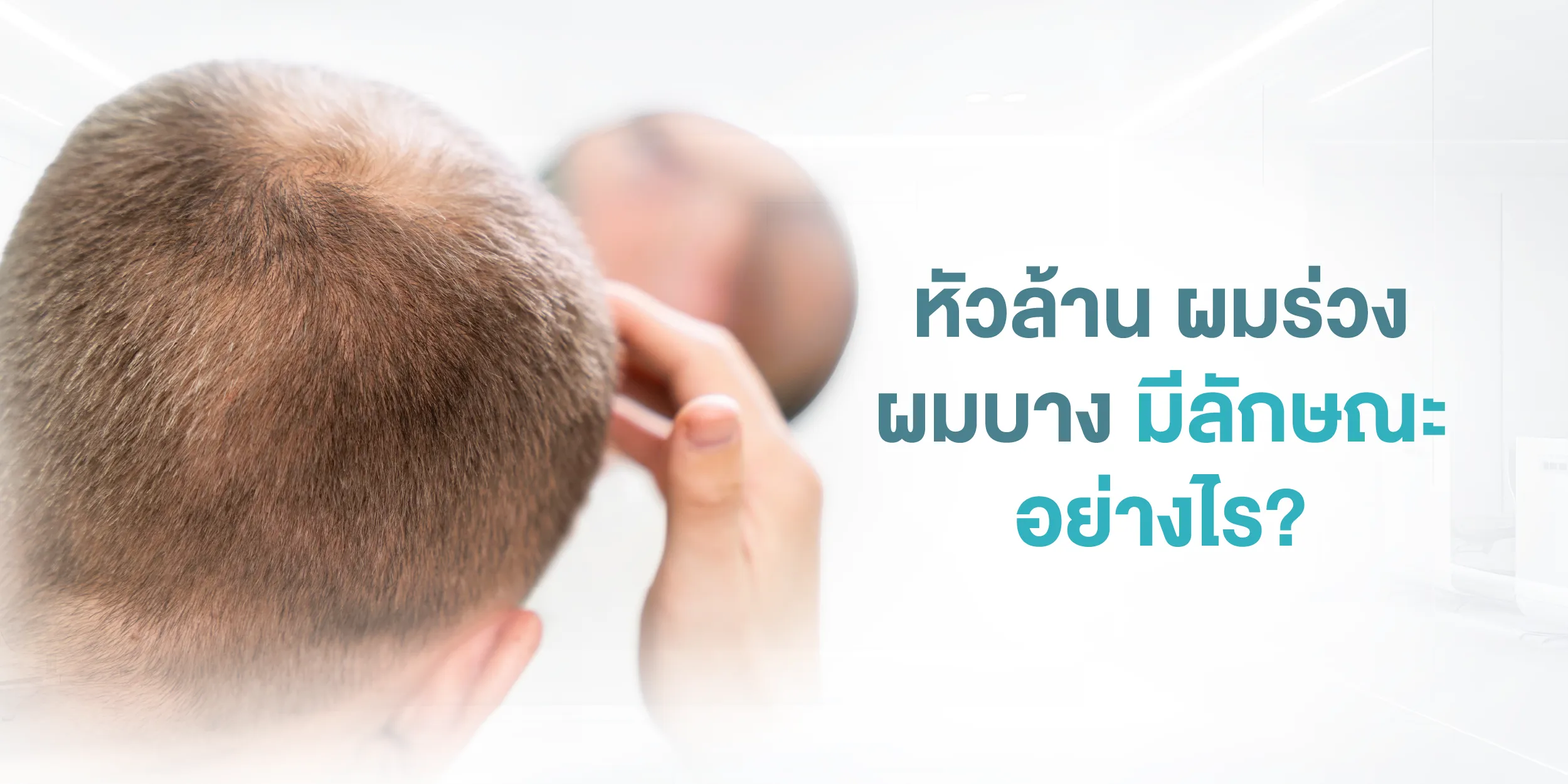 หัวล้าน ผมร่วง ผมบาง มีลักษณะอย่างไร