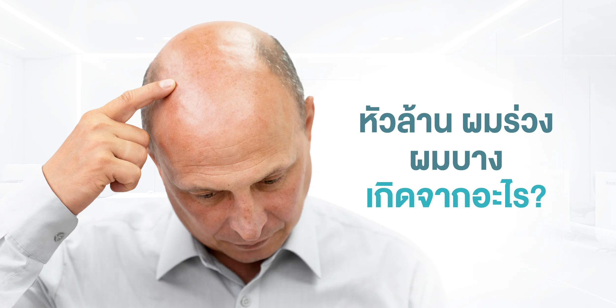 หัวล้าน ผมร่วง ผมบาง เกิดจากอะไร