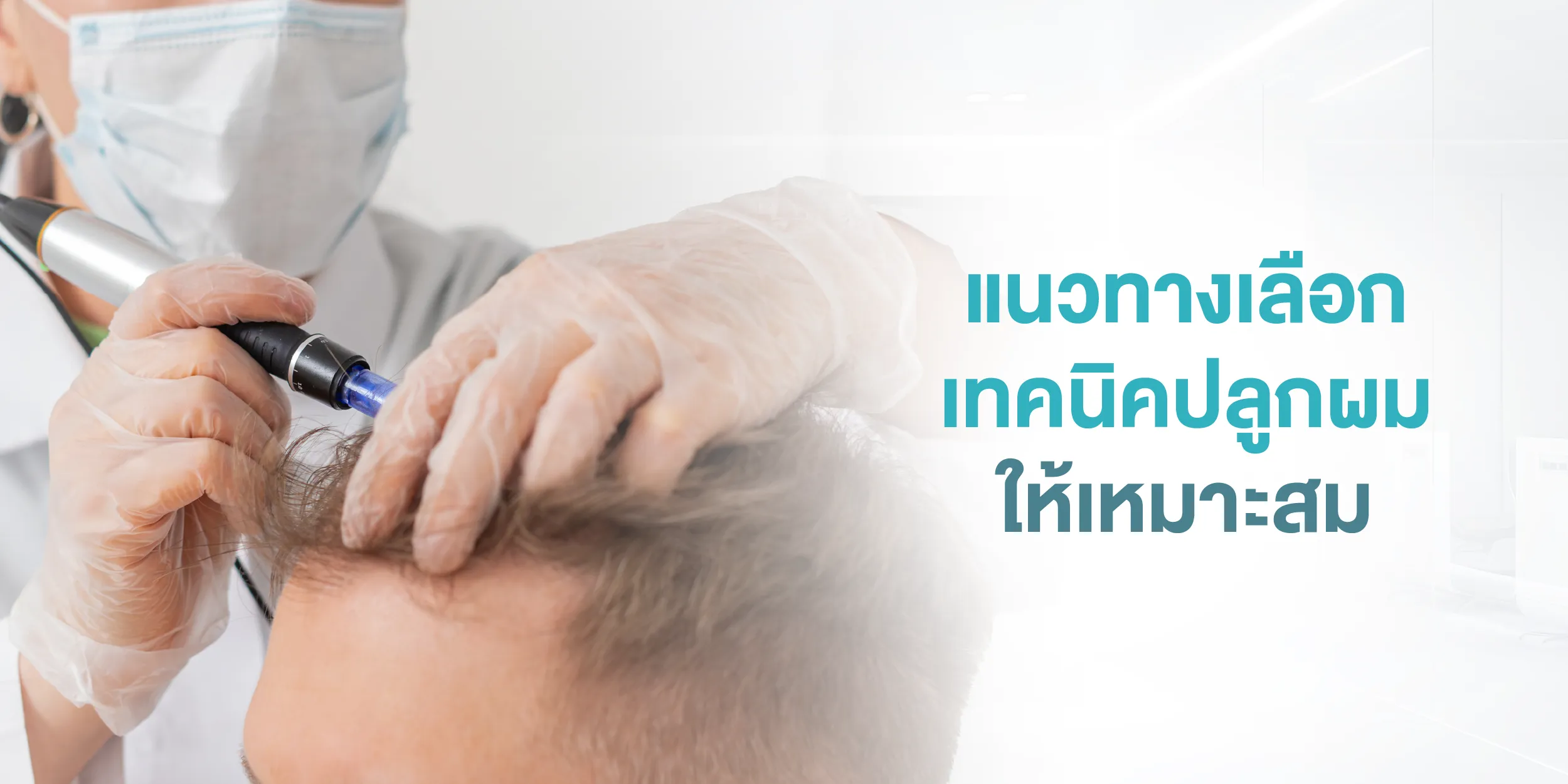 แนวทางเลือกเทคนิคปลูกผมให้เหมาะสม