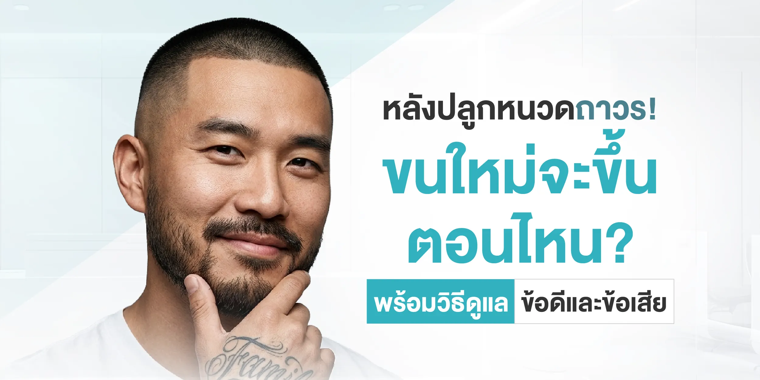 หลังปลูกหนวดถาวร! ขนใหม่จะขึ้นตอนไหน พร้อมวิธีดูแล ข้อดีและข้อเสีย