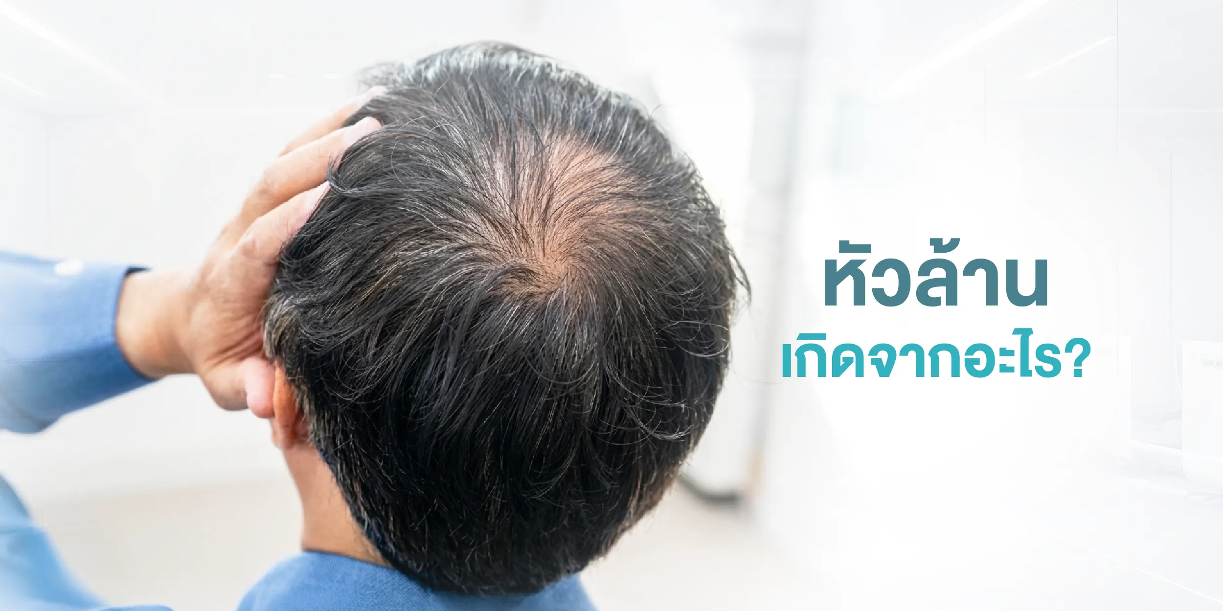 หัวล้าน เกิดจากอะไร