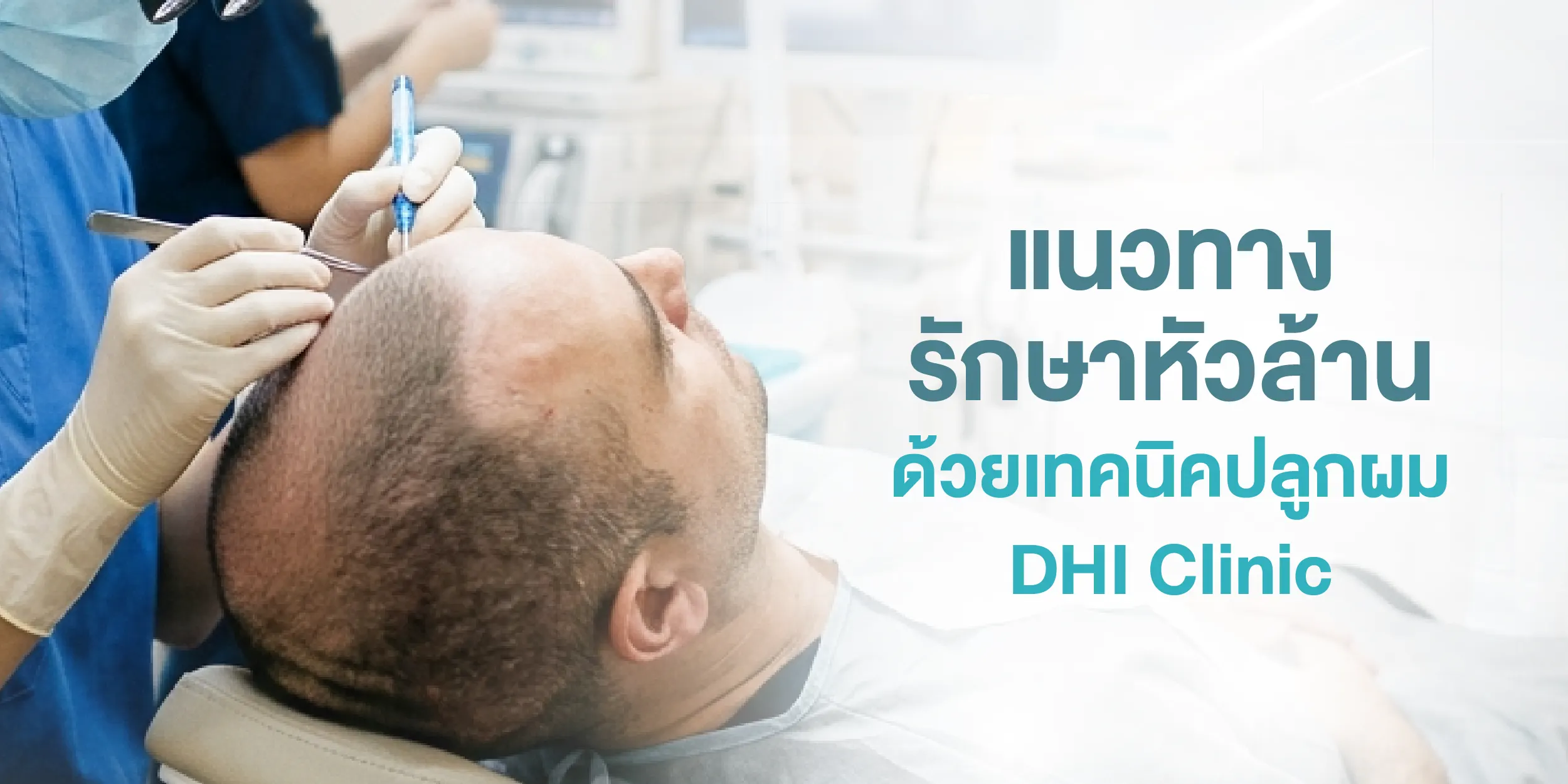 แนวทางรักษาหัวล้านด้วยเทคนิคปลูกผม DHI Clinic