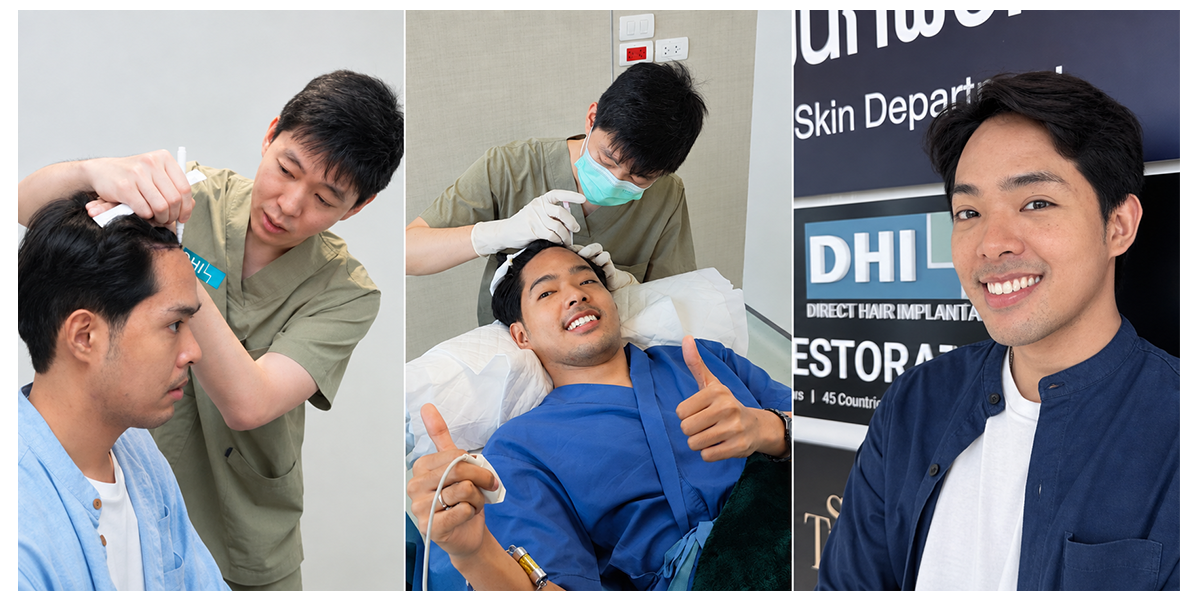 DHI hair transplant procedure in Bangkok